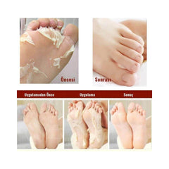 Soft Miracle Foot Peeling Pack